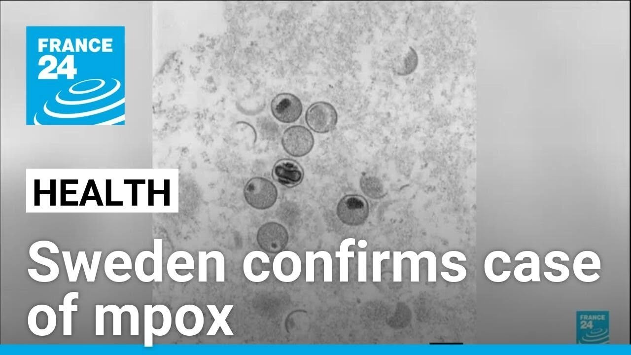 EU Health Agency Alerts Member States to Prepare for Surge in More Contagious Mpox Strain