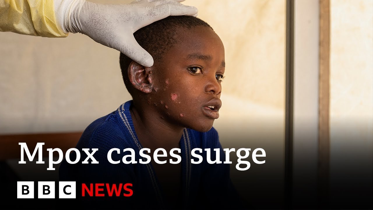 Burundi and DRC Face Surge in Mpox Cases Amid Vaccine Cost Concerns