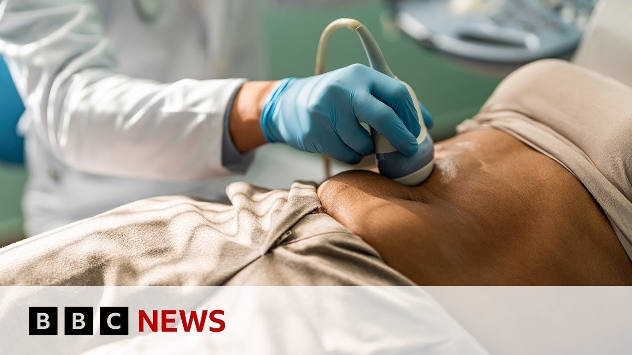 Increase in Bowel Cancer Rates Among Younger Populations, Reports BBC News